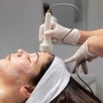 Laser Acne Treatment