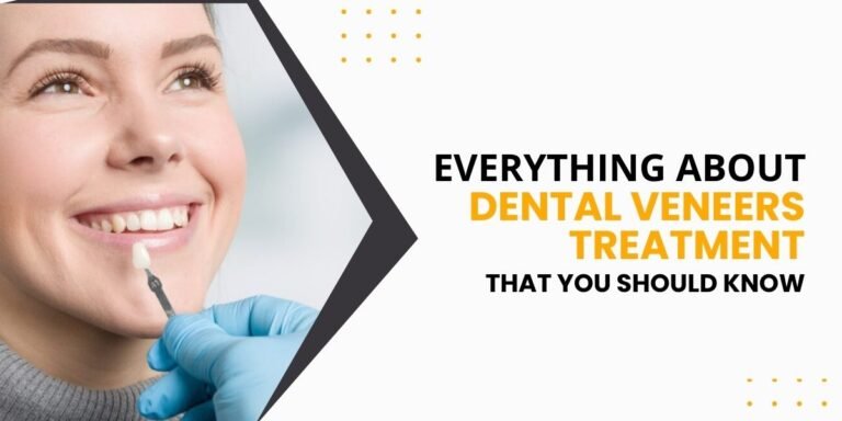 Everything about Dental Veneers Treatment that you should know