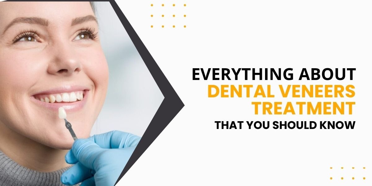 Everything about dental veneers treatment that you should know