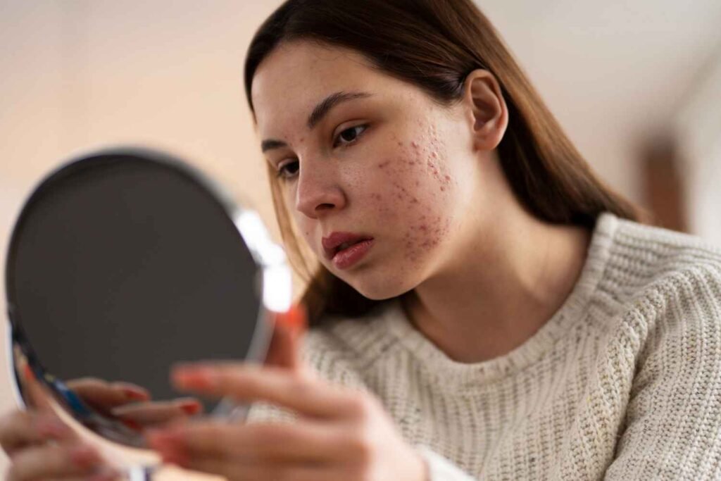 Eye Makeup Allergy
