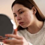 Eye Makeup Allergy